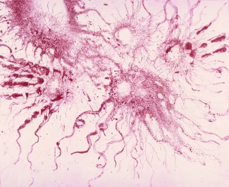 Ets En Aquatint Barcelo - Lanzarote 20