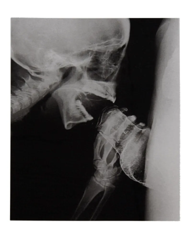 Geïllustreerd Boek Delvoye - Sexrays