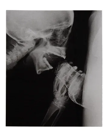 Geïllustreerd Boek Delvoye - Sexrays