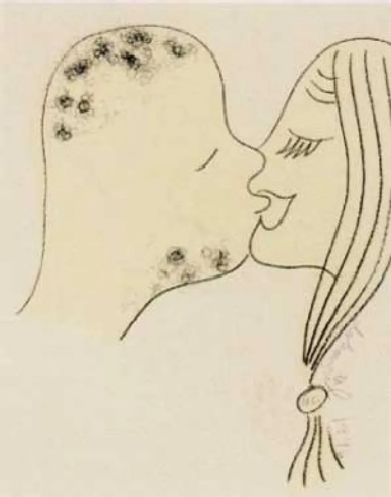 Lithografie Dokoupil - Beso