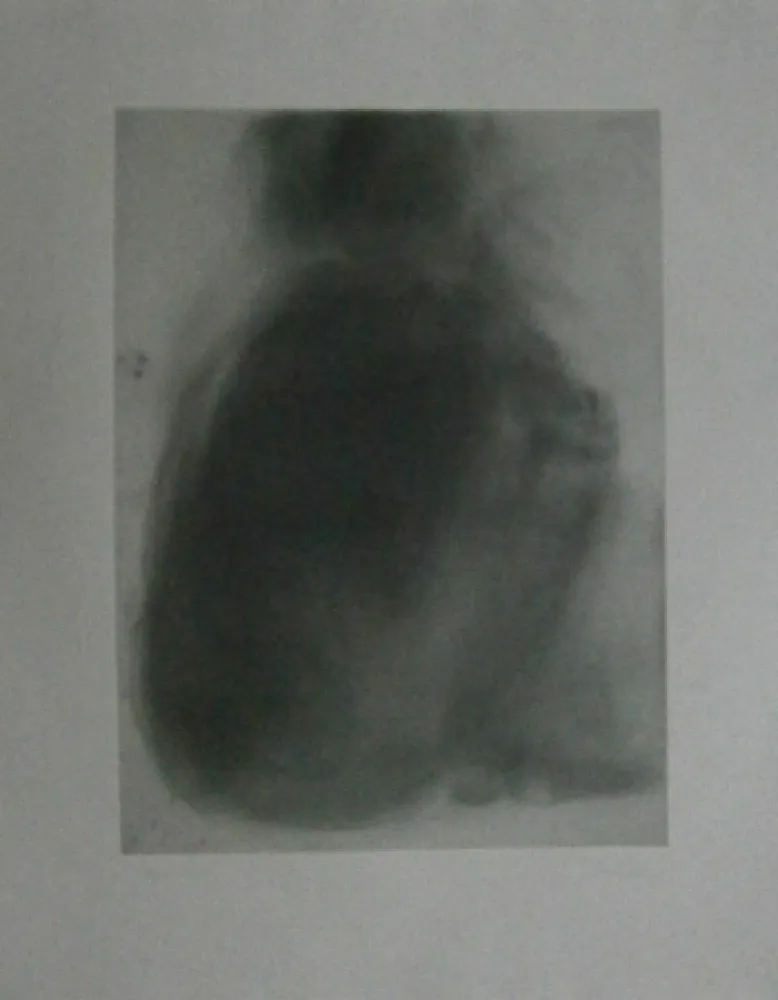 Ets Garache - Tourette