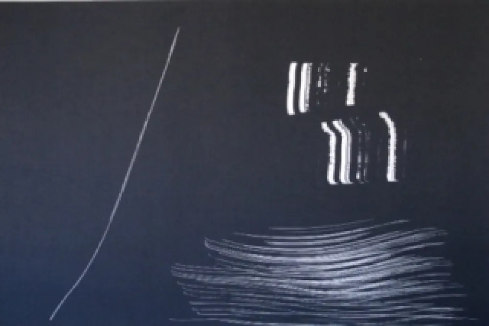 Lithografie Hartung - Farandole 9