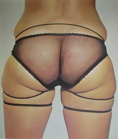 Lithografie Kacere - Loretta 