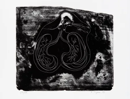 Lithografie Toguo - Reasons to love